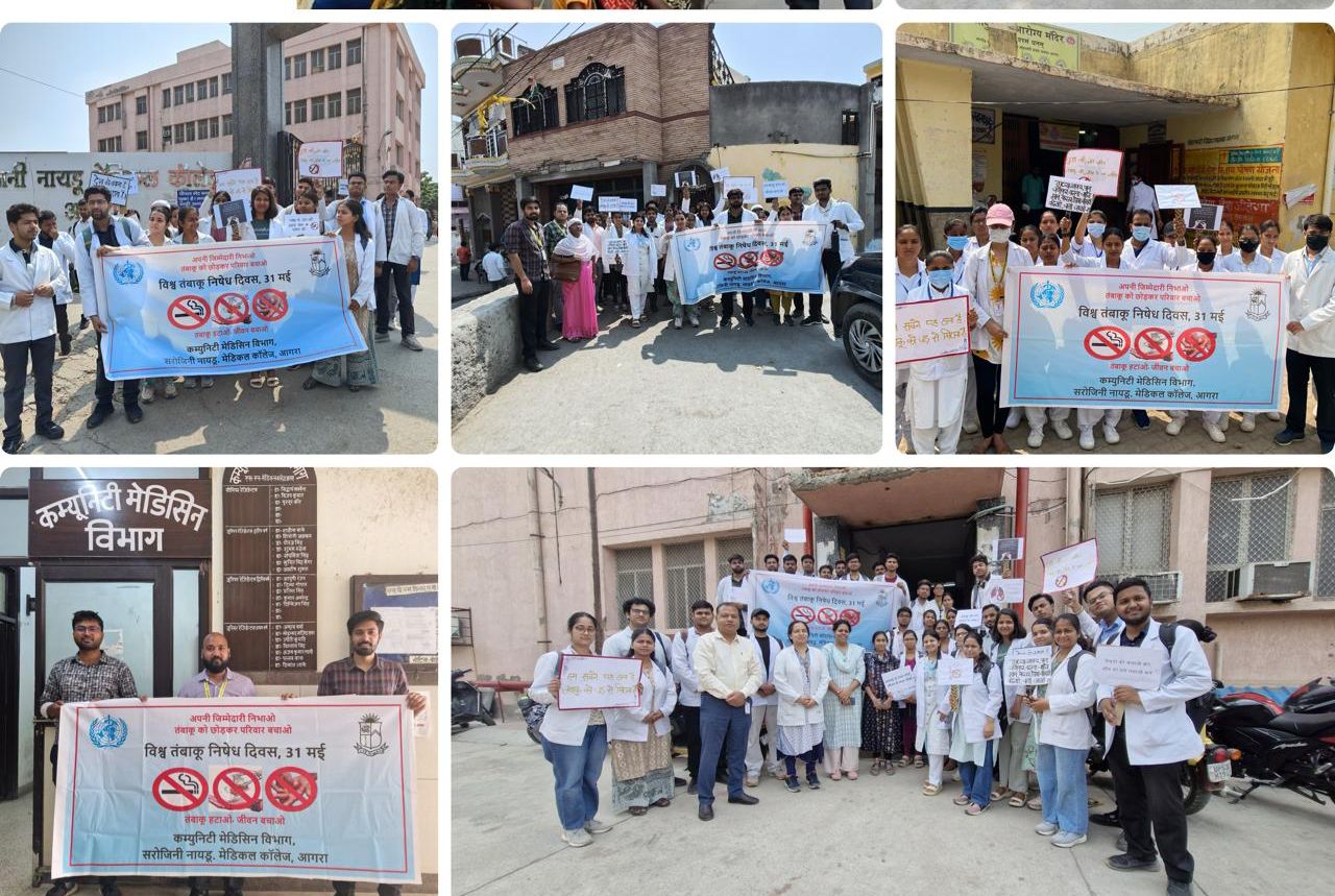 SN मेडिकल कॉलेज में ‘विश्व तंबाकू निषेध दिवस’ कल: युवाओं को तम्बाकू से बचाने पर जोर, संस्थान का ‘डी-एडिक्शन’ अभियान जारी
