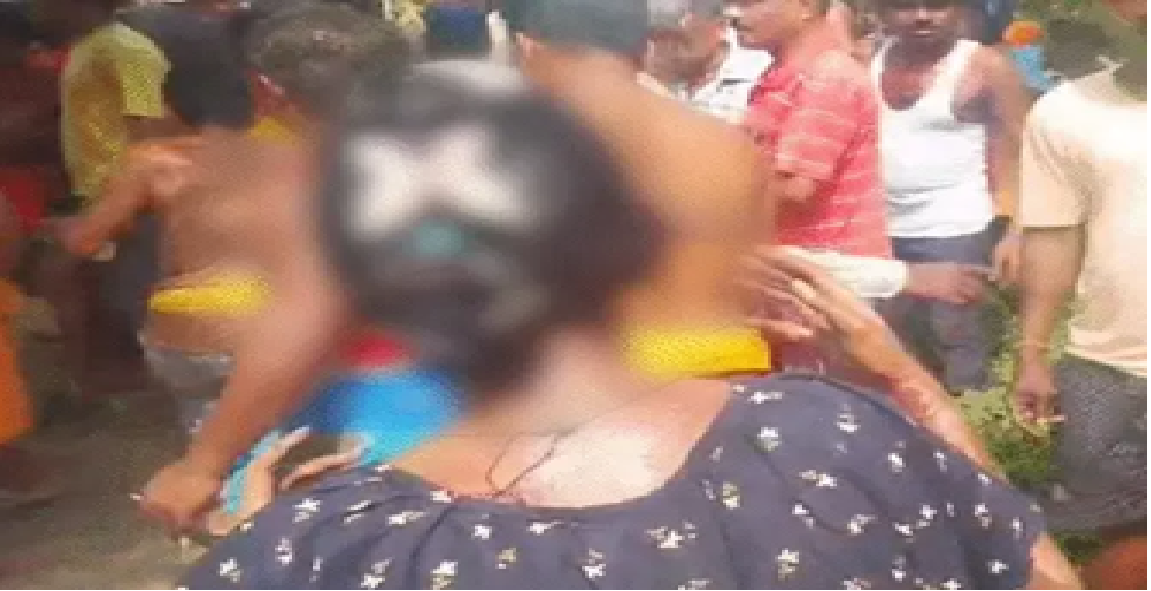 ओडिशा में ‘रूह कंपाने’ वाली वारदात: ‘जलती लड़की दरवाजे पर गिरी, बोली- भैया बचा लो!’ तीन लड़कों ने हाथ-पैर बांधकर जलाया, पुलिस अब भी खाली हाथ!